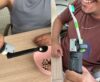 ferramenta de tecnologia assistiva para pessoas com parkison, verstick. 2 usos com colher e com escova de dentes